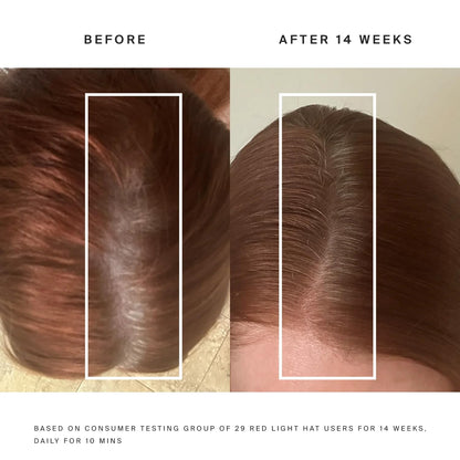 Reviru essential Hair Regrowth & Therapy Cap
